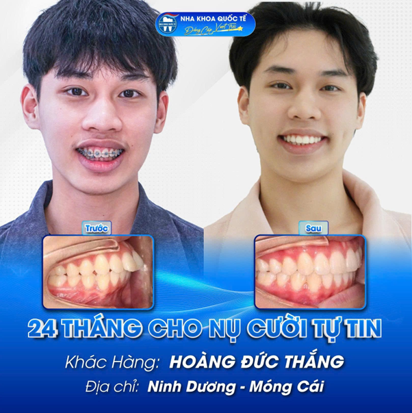 nha-khoa-quoc-te-quang-ninh9-1752139713.png