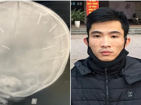 Vụ bé 3 tuổi bị cắm đinh vào đầu: Thực hiện hành vi tàn độc xong, Huyên gửi bé rồi về ngủ