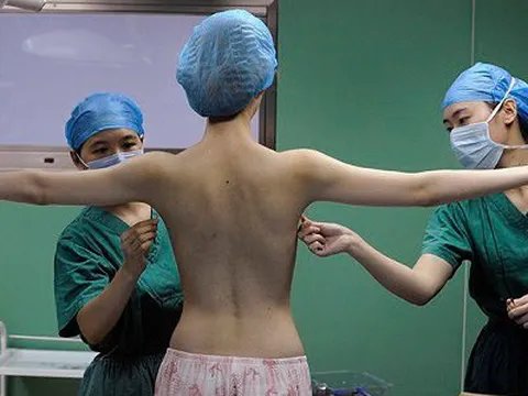 Nâng ngực bao nhiêu tiền? Có loại rẻ hơn một tháng lương