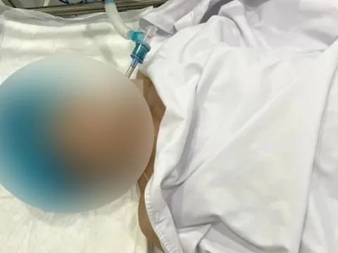 KHẨN: Bộ Y tế vào cuộc vụ người phụ nữ tử vong khi nâng ngực tại TP.HCM