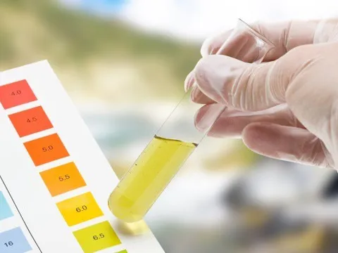 Từ xét nghiệm nước tiểu có thể phát hiện nhiều bệnh cực kỳ nguy hiểm