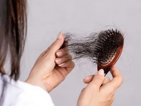 F0 khỏi bệnh đã lâu mà tóc vẫn rụng cả nắm thì phải làm sao?