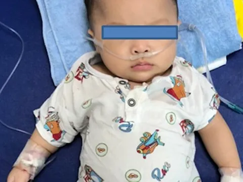 Vì nhiễm COVID-19, bệnh nhi mắc bệnh hiếm gặp của thế giới