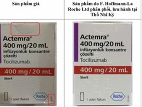 Cảnh báo thuốc giả dùng trong bệnh xương khớp xuất hiện trên thị trường