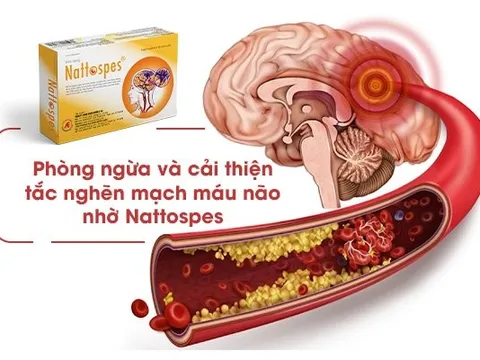 Phòng ngừa và cải thiện tắc nghẽn mạch máu não nhờ Nattospes