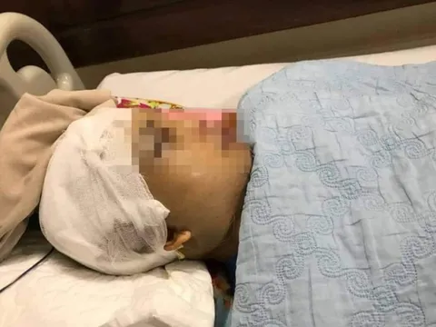 Tạm giữ 2 đối tượng đánh Phó Chủ tịch xã vỡ hộp sọ ở Hải Dương