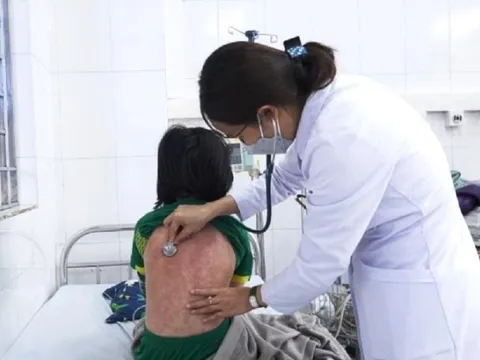 Hơn 300 trẻ ở Tp.HCM mắc hội chứng viêm đa hệ thống hậu Covid-19