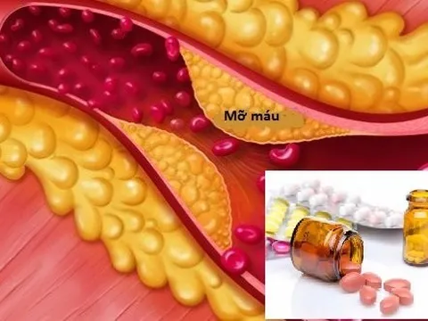 Thu hồi 4 thuốc điều trị tăng mỡ máu chống chỉ định với người châu Á