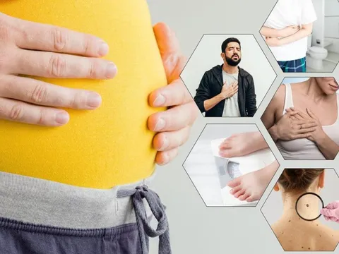 7 cảnh báo đỏ của ung thư: Chỉ có 1 dấu hiệu cũng cần đi khám ngay lập tức