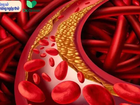 Gầy như 'xác ve' vẫn máu nhiễm mỡ: Bác sĩ chỉ ra 'thủ phạm' cả triệu dân văn phòng mắc