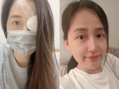 Mai Phương Thúy đăng ảnh băng kín một mắt, loạt sao lo lắng hỏi thăm