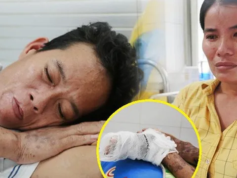 Đường cùng của người cha bị ung thư, hoại tử chân sống thoi thóp trong bệnh viện