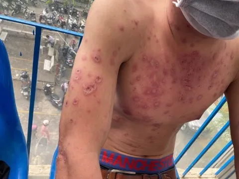 Nam bệnh nhân Long An mắc căn bệnh cực hiếm, cả thế giới chỉ có 95 người mắc