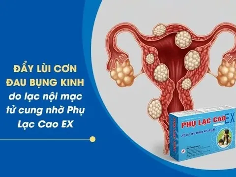 Đẩy lùi đau bụng kinh do lạc nội mạc tử cung nhờ Phụ Lạc Cao EX