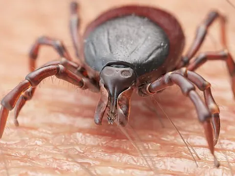 Người đàn ông tử vong do nhiễm một loại virus cực hiếm gặp sau khi bị bọ ve cắn