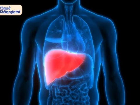 Không uống rượu bia vẫn gan nhiễm mỡ: Bác sĩ chỉ ra 'thủ phạm' rất nhiều dân văn phòng mắc