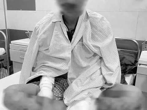 Dùng điện thoại khi đang sạc, nam thanh niên bị cháy toàn thân