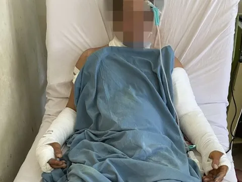 Khánh Hòa: Cứu sống bệnh nhân choáng mất máu do đứt động mạch cánh tay