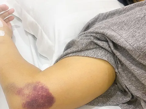 Người phụ nữ 20 năm chống chọi với ung thư máu, xơ gan: Thái độ sống khiến ai cũng nể phục