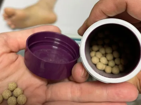 Cụ bà mệt lả, thở nhanh sau 3 tháng uống thuốc có chất cấm từ năm 1978