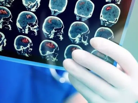 Số ca mắc COVID-19 mới giảm xuống 5.109; cả nước chỉ còn hơn 400 F0 nặng