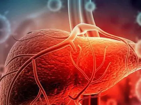 Viêm gan bí ẩn ở trẻ em xuất hiện tại Đông Nam Á, 3 trẻ tử vong