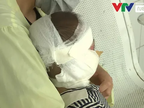 Cảnh báo: Gia tăng trẻ nhỏ bị bỏng nhiệt