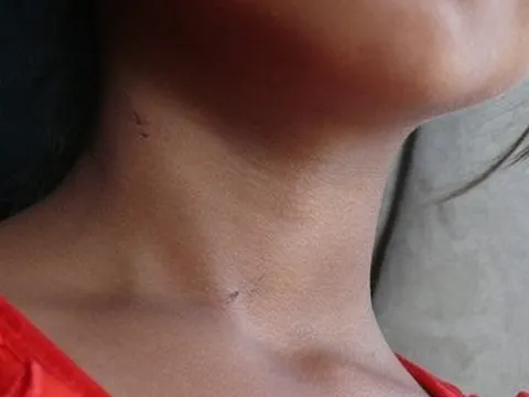 Truy tố cặp vợ chồng "hờ" và góc khuất sau một vụ án