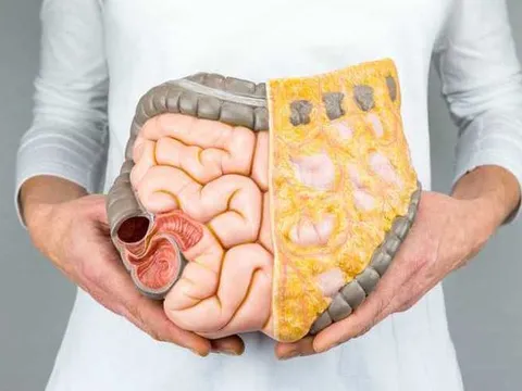 Hệ tiêu hoá là gốc trường thọ: Chuyên gia chỉ thói quen tàn phá hệ tiêu hoá của người Việt