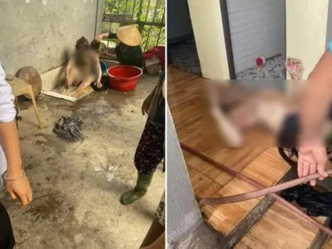 Hải Dương: Nghi do mâu thuẫn, chồng đốt phòng ngủ khiến 3 người bị thương