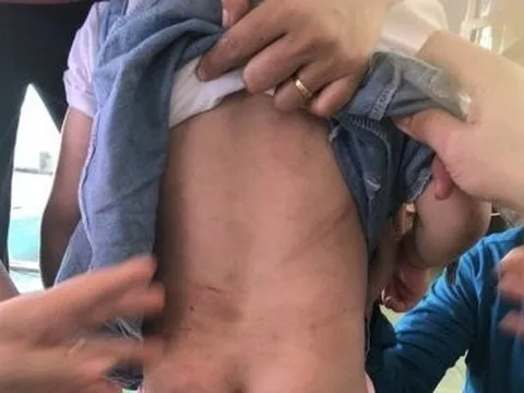 Khởi tố vụ án dì ruột dùng chổi sắt đánh cháu bé 4 tuổi nhập viện ở Hà Tĩnh