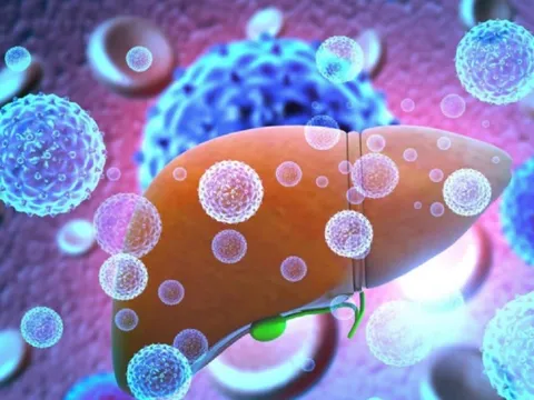 Số ca viêm gan bí ẩn ở trẻ trên thế giới chạm ngưỡng 300: 9 dấu hiệu không được bỏ qua