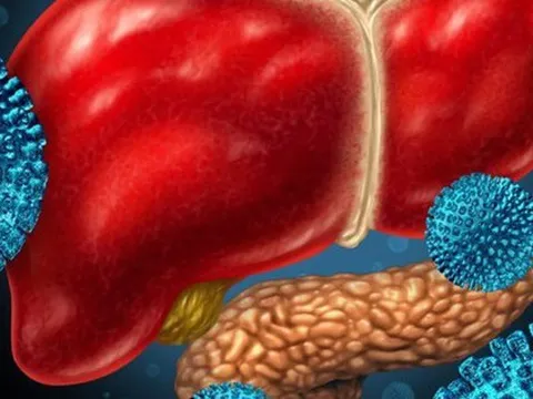 Viêm gan bí ẩn ở trẻ em: Bác sĩ Việt ở Mỹ nhắc 4 điều cha mẹ nên làm để bảo vệ trẻ