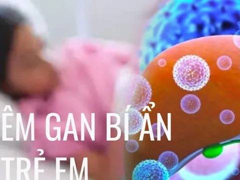 Bộ Y tế khuyến cáo cách phòng chống bệnh viêm gan cấp tính 'bí ẩn' ở trẻ em