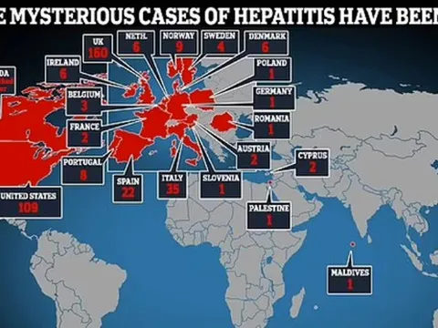 Bệnh viêm gan bí ẩn tiếp tục diễn biến phức tạp trên toàn thế giới