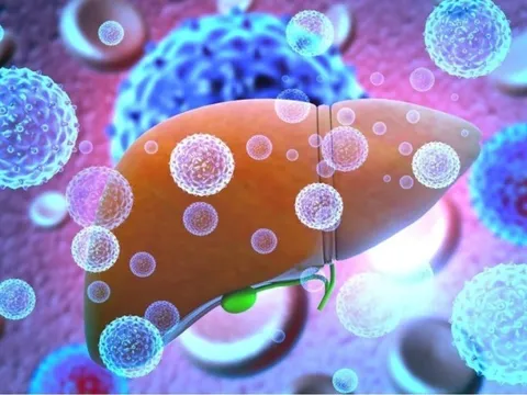 Nghi vấn thủ phạm số 1 gây viêm gan bí ẩn ở trẻ: Chuyên gia chỉ cách phòng, phát hiện sớm