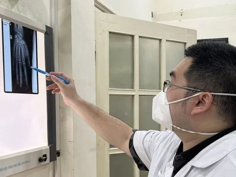 Dập nát bàn tay do điện thoại phát nổ khi vừa chơi game vừa sạc pin