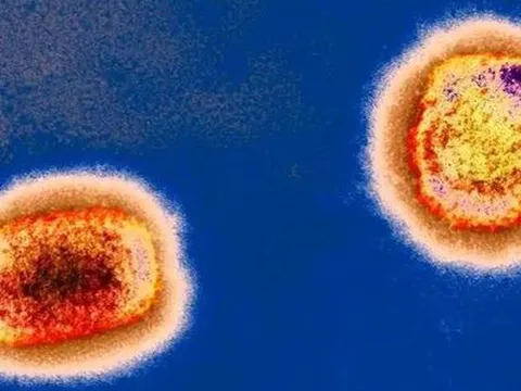 Bỉ cách ly 21 ngày với người mắc bệnh đậu mùa khỉ; Anh bắt đầu triển khai tiêm vaccine
