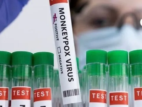 Số ca bệnh đầu mùa khỉ tăng, WHO đề nghị hợp tác với ICMR