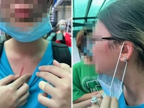 ĐBQH sững sờ vì bạo lực xảy ra trong chính môi trường quốc tế danh giá