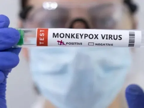 Bệnh đậu mùa khỉ lan nhanh, đã có 10 ca tử vong ở vùng lưu hành
