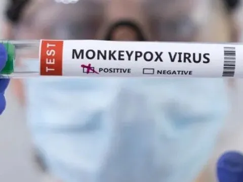 Làm thế nào để bảo vệ bản thân khỏi nguy cơ mắc bệnh đậu mùa khỉ?