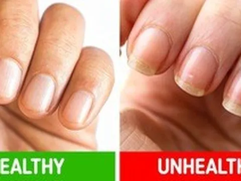 8 “dấu hiệu” bệnh tật nguy hiểm mà chúng ta thường bỏ qua