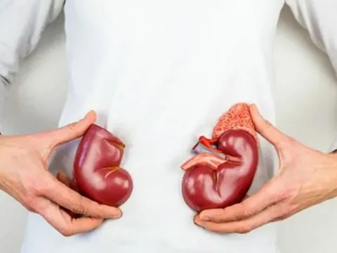 9 thói quen xấu dẫn đến suy thận, cần từ bỏ ngay