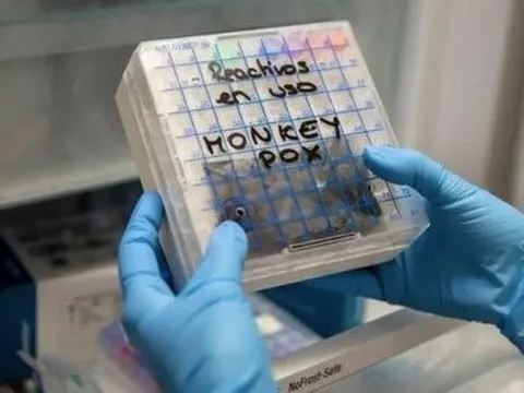 Bệnh đậu mùa khỉ tiếp tục lan rộng, lo ngại thế giới 'bị động' đối phó