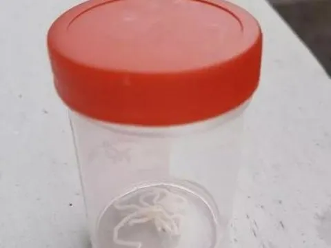 Kéo giun dài 8cm ra từ tay của người đàn ông “nghiện” ăn gỏi cá