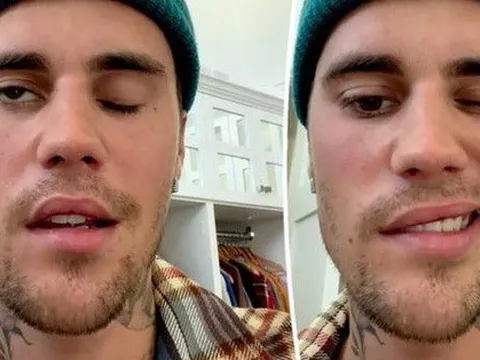 Justin Bieber gặp khó khăn trong ăn uống sau khi liệt nửa mặt