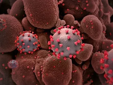 Thay đổi khó tin trong cơ thể nếu mắc Covid-19 trong hoàn cảnh này