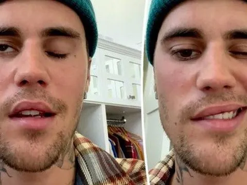 Justin Bieber rất hoảng sợ và lo lắng về tác dụng phụ của hội chứng gây liệt nửa mặt