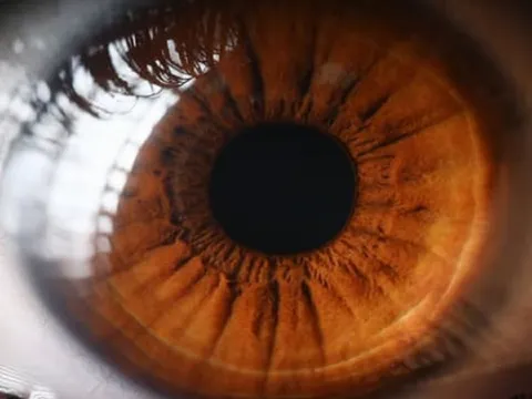 Nghiên cứu: Khám mắt có thể dự đoán nguy cơ đau tim